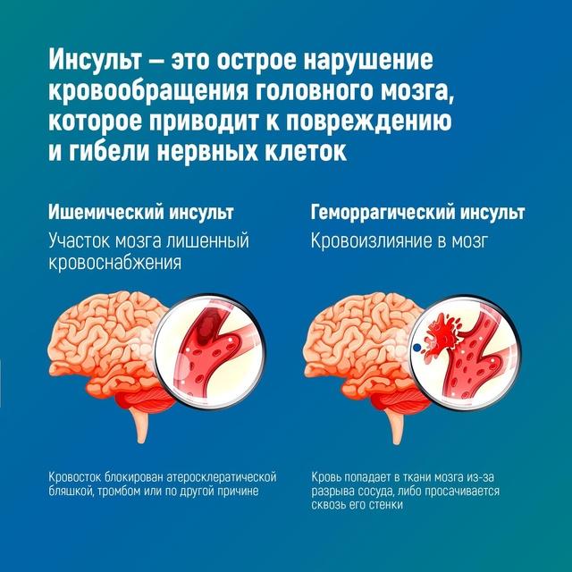 28 октября - 03 ноября 2024 года - НЕДЕЛЯ БОРЬБЫ С ИНСУЛЬТОМ